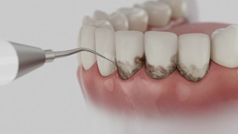 Trusted Dental Implants service in Conway Springs, KS - Dentist Open Now